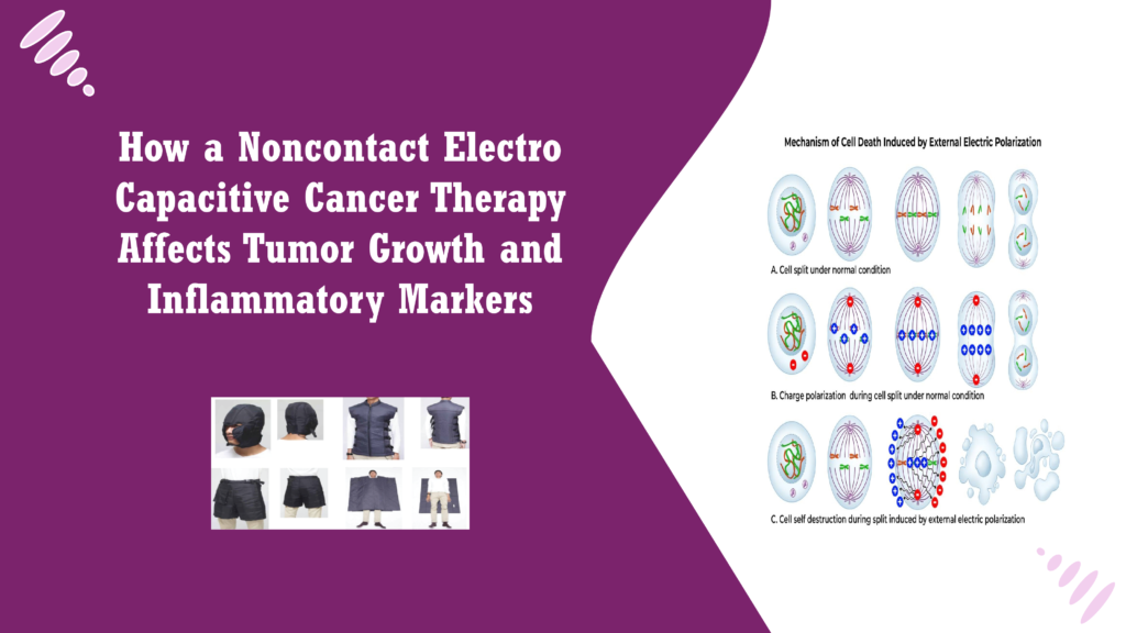 How a Noncontact Electro Capacitive Cancer Therapy Affects Tumour Growth and Inflammatory Markers