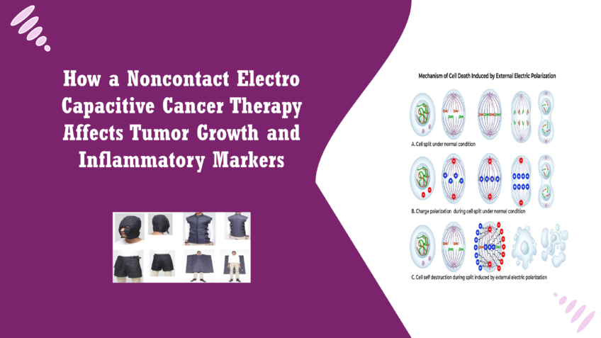 Noncontact Electro Capacitive Cancer Therapy