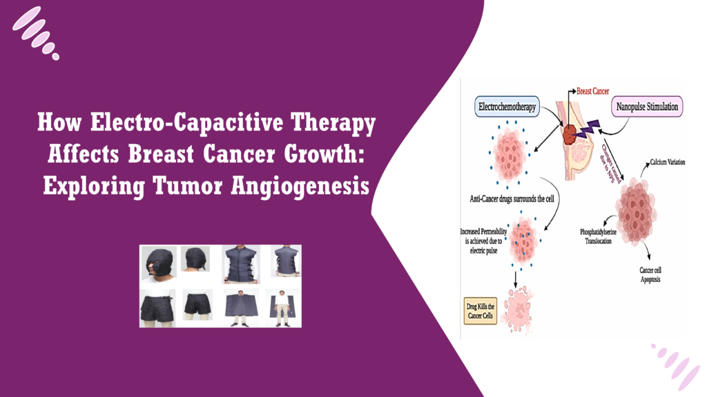 How Electro-Capacitive Therapy Affects Breast Cancer Growth: Exploring Tumor Angiogenesis