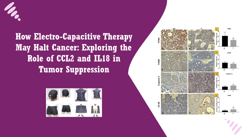 How Electro-Capacitive Therapy May Halt Cancer: Exploring the Role of CCL2 and IL18 in Tumor Suppression