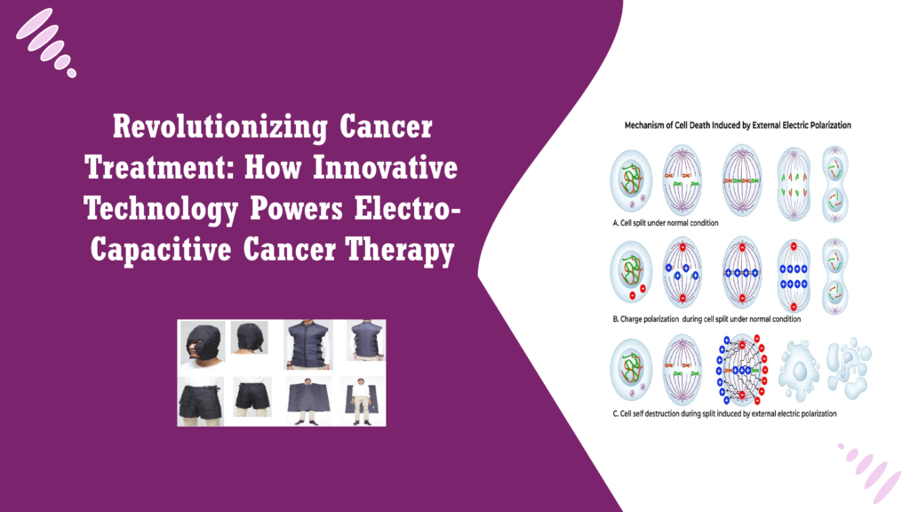 Revolutionizing Cancer Treatment: How Innovative Technology Powers Electro-Capacitive Cancer Therapy